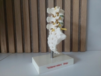 Anatomisch model wervelkolom