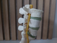 Anatomisch model wervelkolom